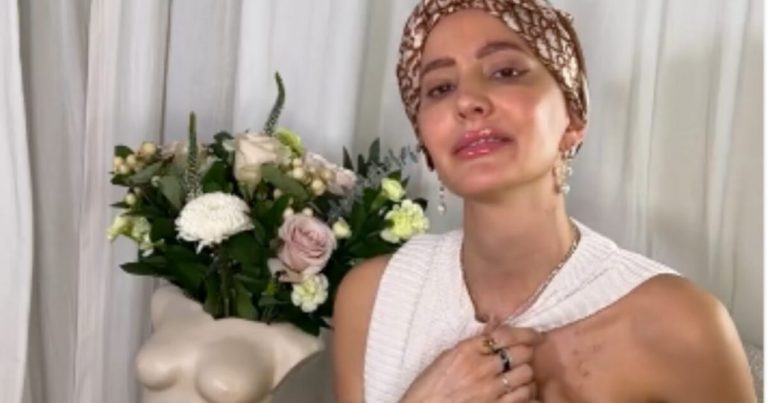 «Me cansé de fingir con una peluca»: Aylén Milla revela que padece cáncer de mama