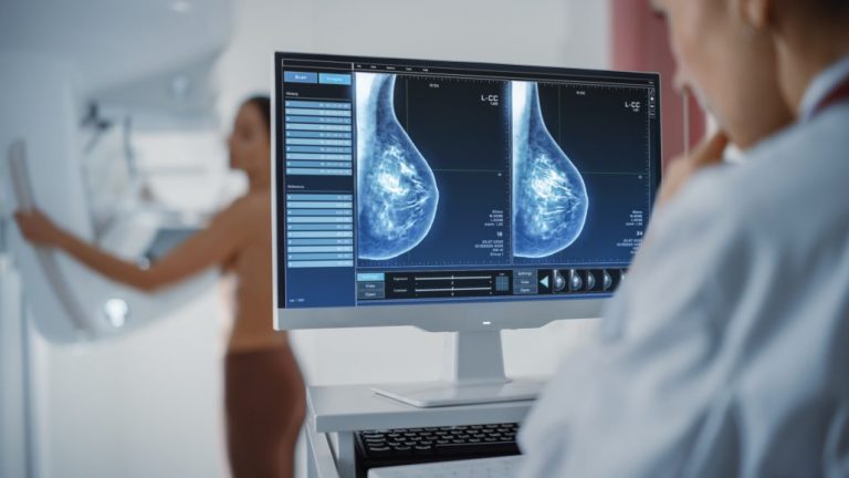 Muertes por cáncer de mama disminuyeron en la región del Biobío: Hazte el examen