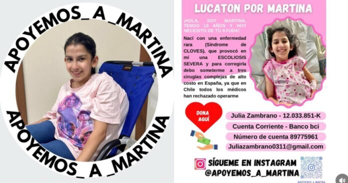 ¡Lucatón por Martina!: Niña de Angol necesita reunir $200 millones para acceder a la única operación que puede salvar su vida